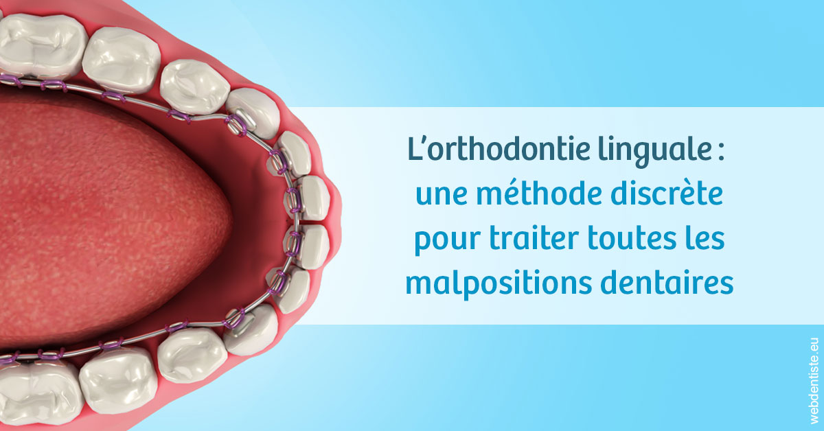 https://dr-coat-philippe.chirurgiens-dentistes.fr/L'orthodontie linguale 1