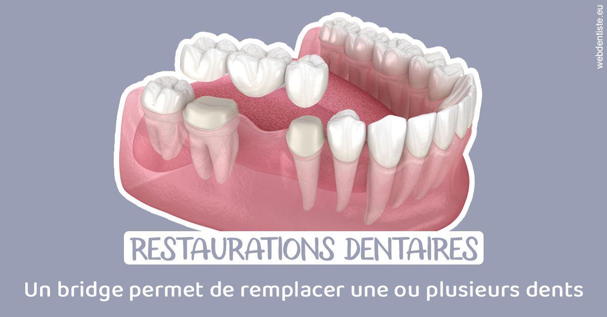 https://dr-coat-philippe.chirurgiens-dentistes.fr/Bridge remplacer dents 1