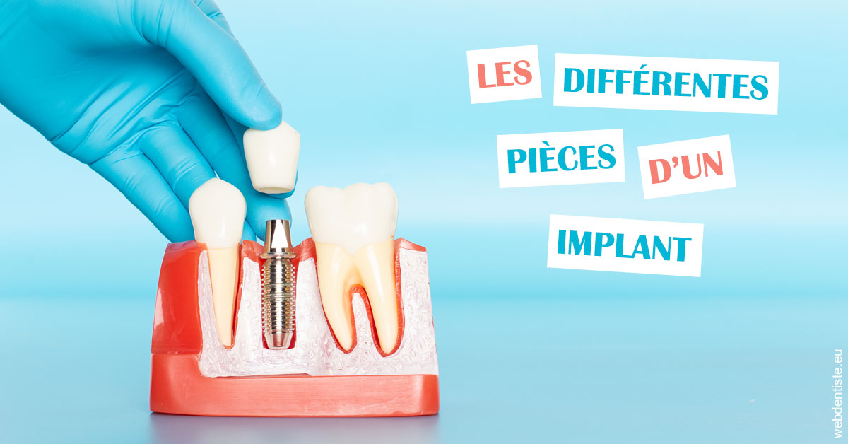 https://dr-coat-philippe.chirurgiens-dentistes.fr/Les différentes pièces d’un implant 2