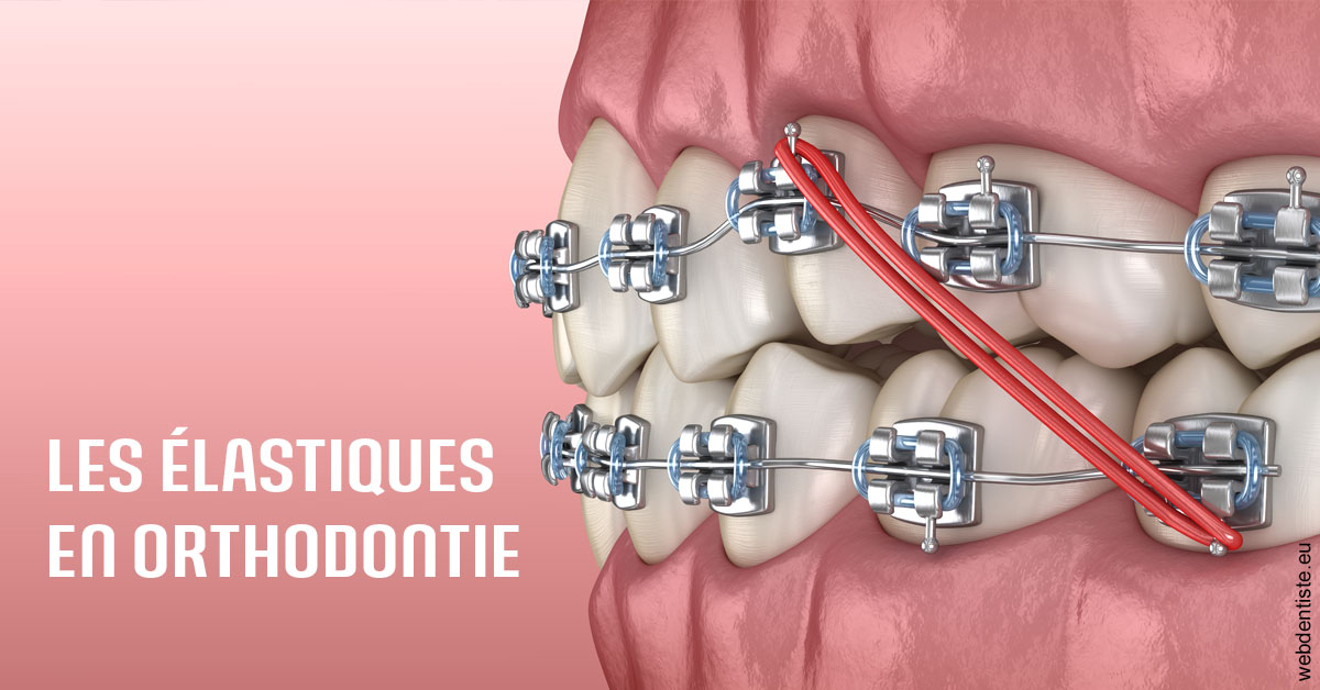 https://dr-coat-philippe.chirurgiens-dentistes.fr/Elastiques orthodontie 2